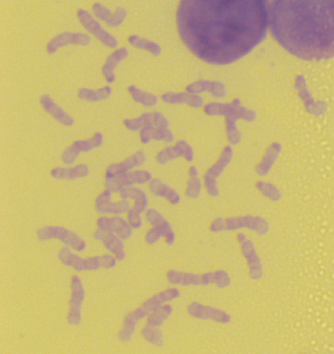 Кариотипический анализ iPS-клеток показал, что примерно у 75% из них, как и положено, по 40 хромосом. Учёным приходилось пересчитывать около сотни составляющих для каждого образца индуцированных плюрипотентных клеток (фото Nature).