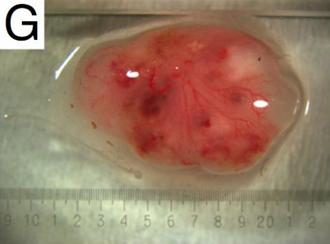 Тератома (опухоль, выращенная из клеток, перепрограммированных в стволовые) содержала все три зародышевых слоя (фото PNAS)<!-- SP1626D331 -->.